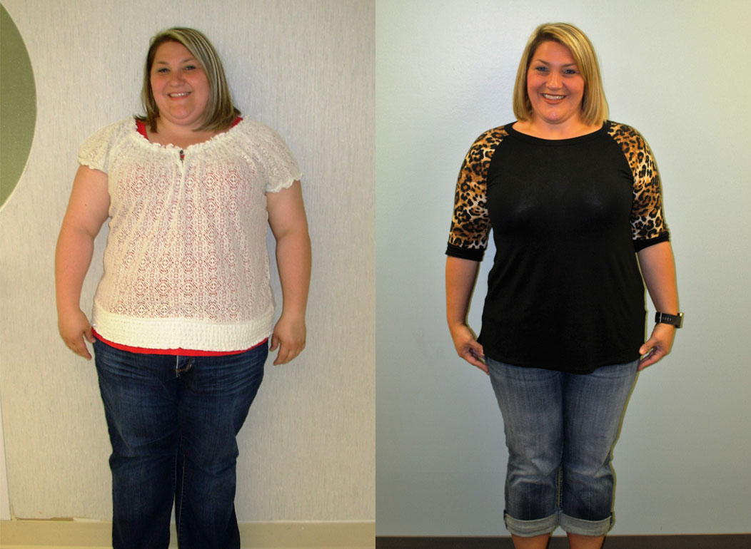 Ashley s Weight Loss Transformation St Louis Bariatrics