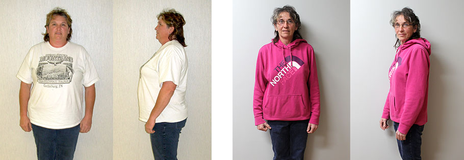 Sheila's weight loss story