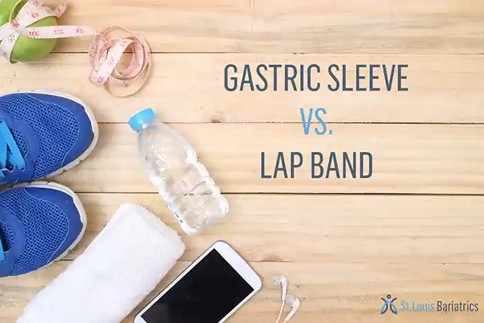 gastric sleeve vs. lap band