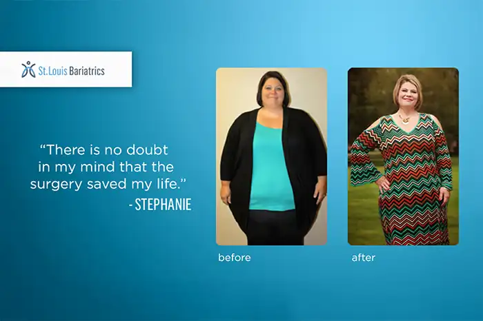 stephanie's weight loss transformation