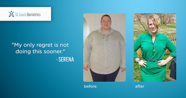 Serena's Weight Loss Story