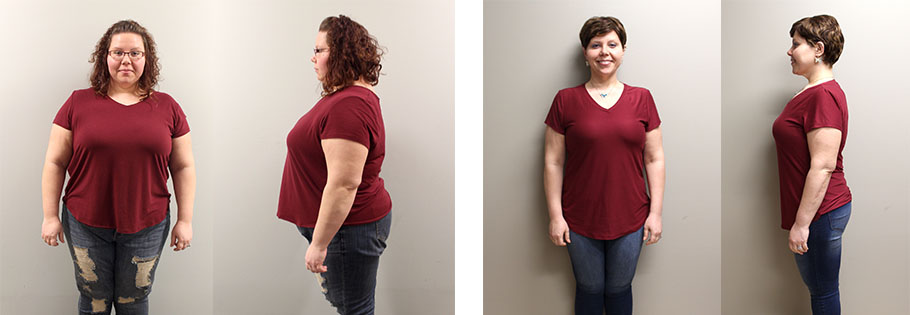 Many's gastric sleeve success story