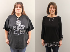 Kathi's weight loss transformation