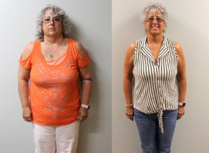 Cynthia's weight loss transformation