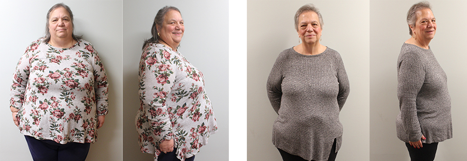 Deborah's weight loss transformation