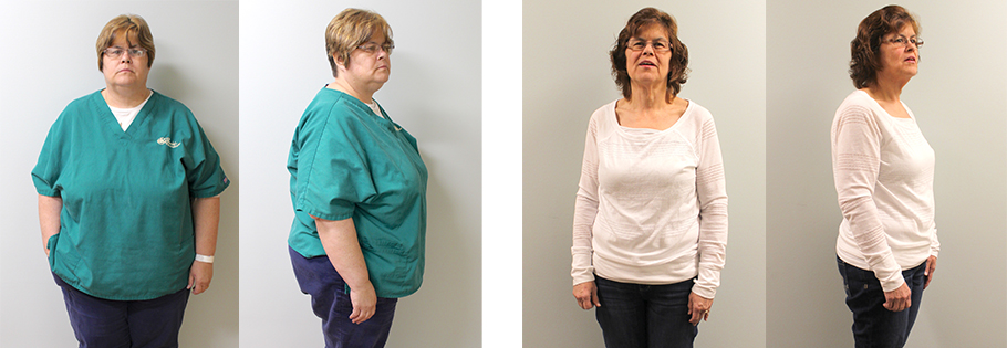 Shelia's weight loss transformation