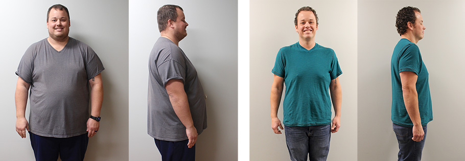 Michael's weight loss transformation