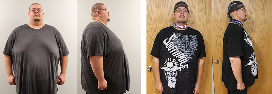 Jeremy's weight loss transformation