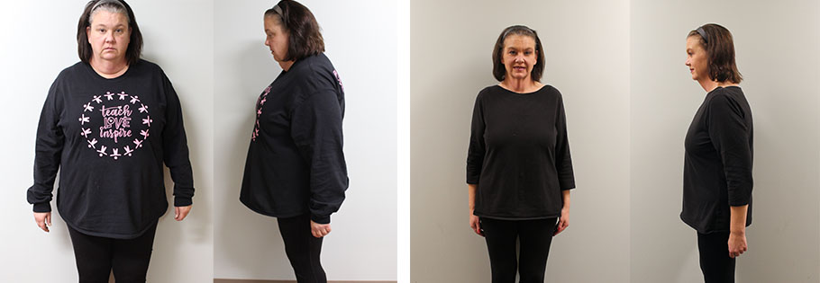 Jill's weight loss transformation