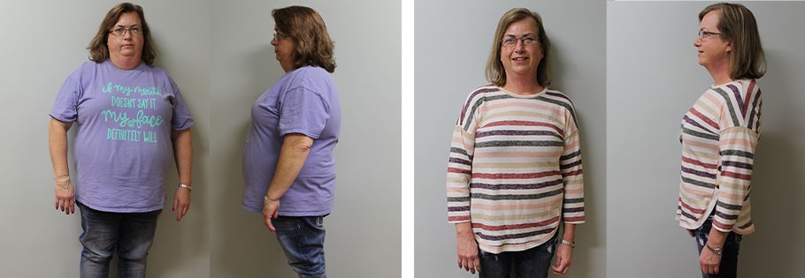 Melissa's weight loss transformation