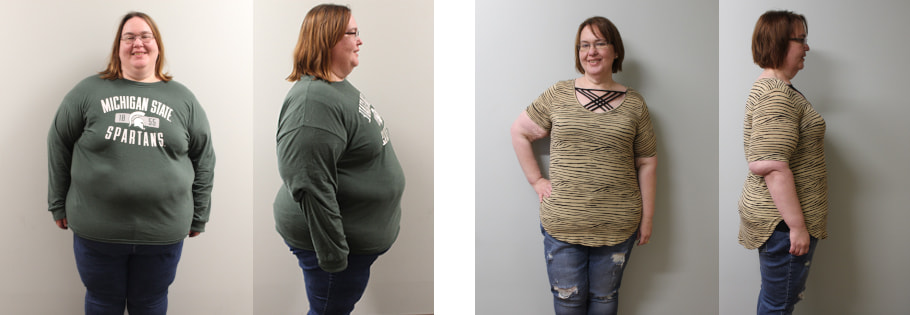 Suzanne's weight loss transformation