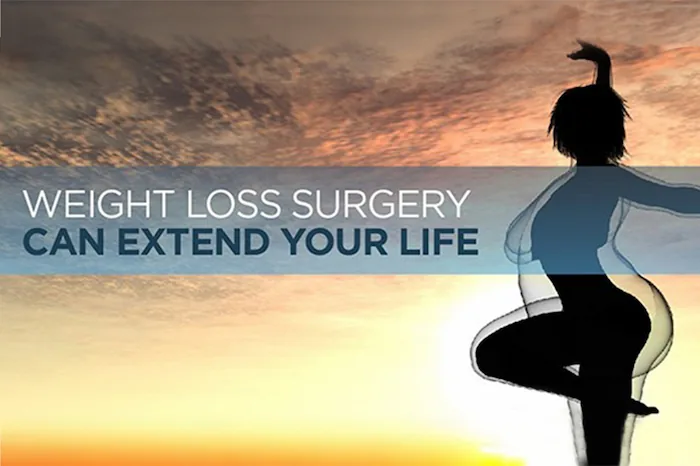 weight loss surgery can extend your life graphic