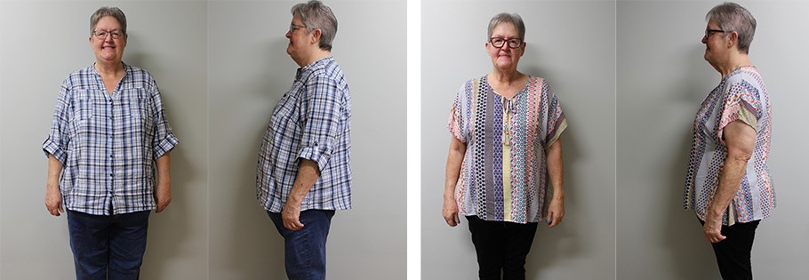 Julie's weight loss transformation