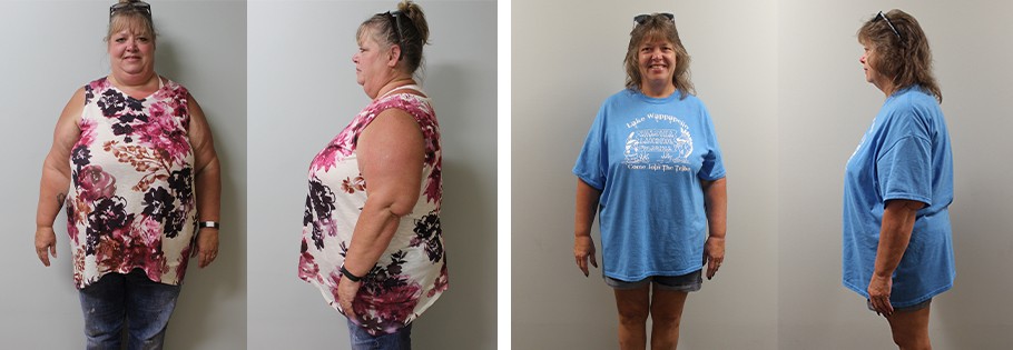 Hogan's weight loss transformation