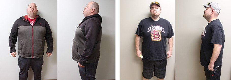 Matthew's weight loss transformation