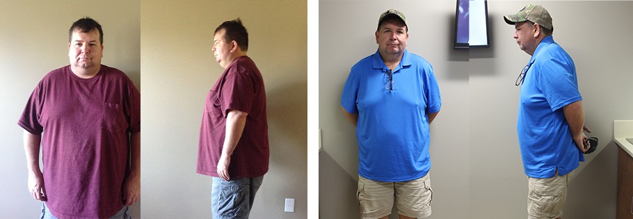 Michael's weight loss transformation