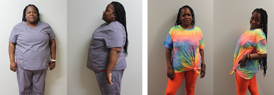 Latosha's weight loss transformation