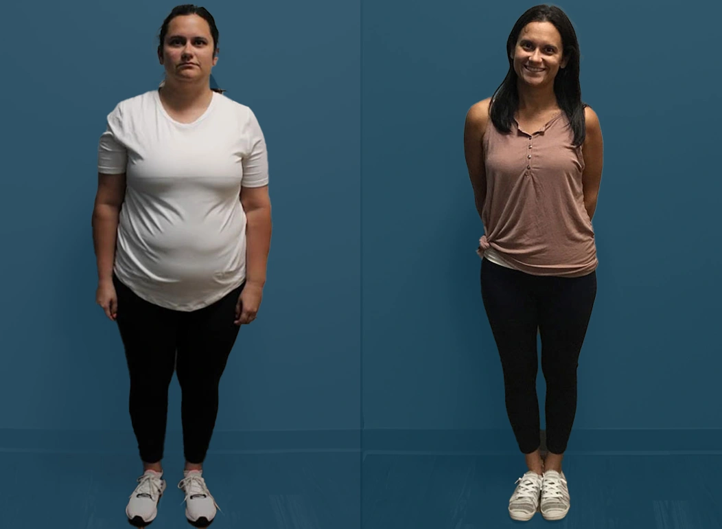 STLB Patient Before and After